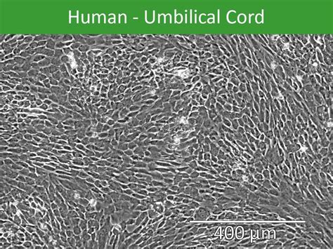 Human Umbilical Cord Derived Mesenchymal Stem Cells Female Jangocell