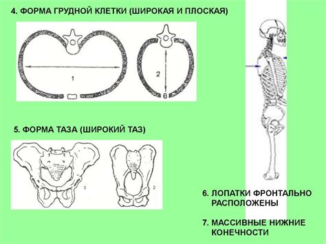 Скелет человека. Особенности скелета. Нарушения осанки и плоскостопие ...