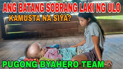 ANG PAGSUBOK NG MAG ASAWA NA KATUTUBO NA MAY MALAKING ULO ANG ANAK