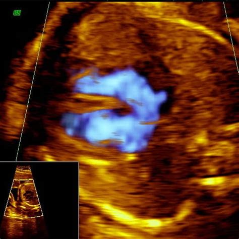 Significado Do Nome Jasmim Fetalmed Medicina Fetal Em Curitiba