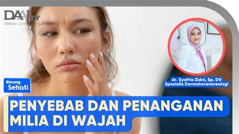 Penyebab Dan Penanganan Milia Di Wajah Bincang Sehati YouTube