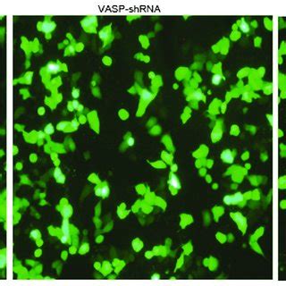 RAC1 And VASP MRNA Expression In Tumor And Normal Tissue A RAC1 MRNA