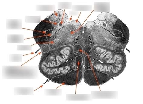 Rostral Medulla 1 Diagram Quizlet