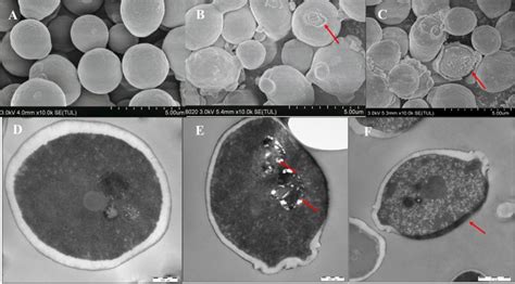 A Scanning Electron Micrographs Of Untreated C Albicans Cells B C