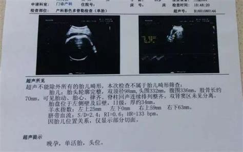 怀孕36周b超单图片36周b超单子正常图片 伤感说说吧