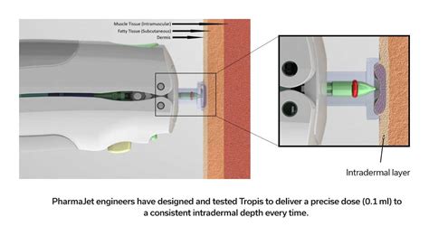 tropis id jet injector needle  injection system pharmajet