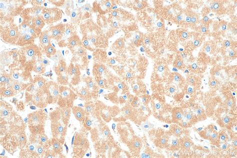 TOM20 antibody 80501 1 RR Proteintech 武汉三鹰生物技术有限公司