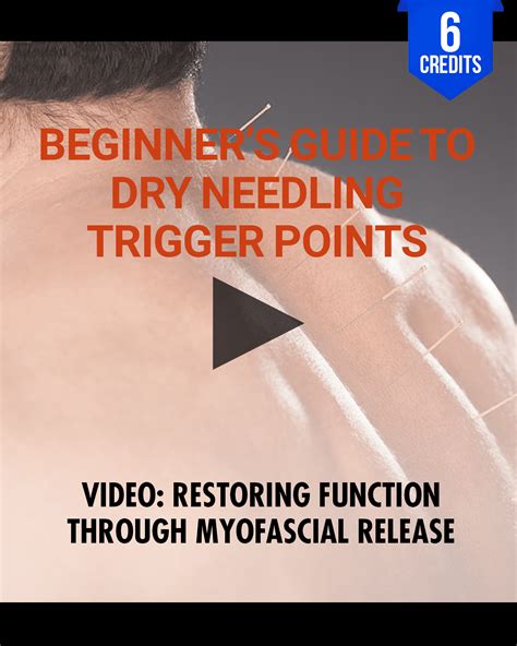 Beginner's Guide to Dry Needling Trigger Points: Restoring Function Th