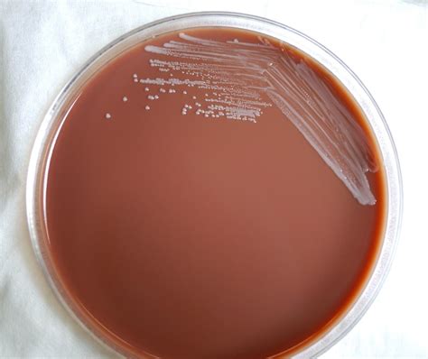 Free Picture Gram Negative Brucella Abortus Bacteria Grown Blood Agar