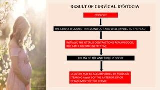 Midwifery cervical dystocia | PPT