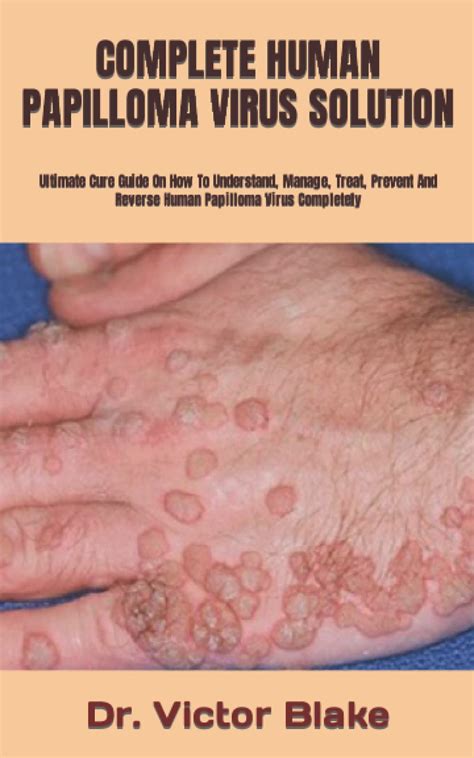 Buy Complete Human Papilloma Virus Solution Ultimate Cure Guide On How