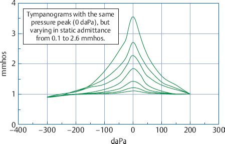 Acoustic Immittance Assessment | Ento Key