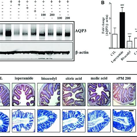 Detection Of Aqp And Mucin Levels In The Colon A Effects Of P Mume