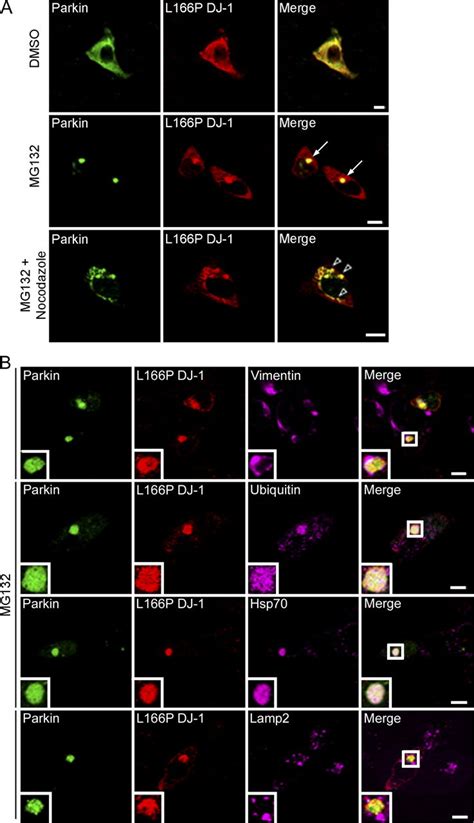 Colocalization Of L166P Mutant DJ 1 And Parkin In Perinuclear