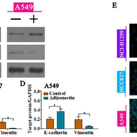 Adiponectin Promotes E Cadherin Expression And Downregulates Vimentin