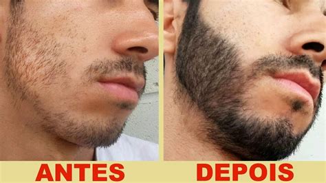 Como Ter Barba De Uma Forma Natural Youtube