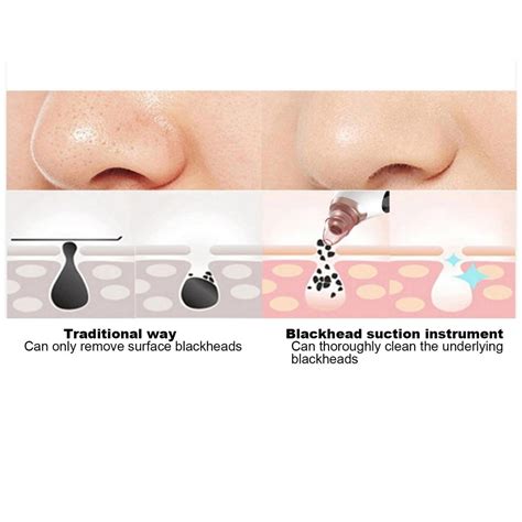 Buy Electric Blackhead Removal Machine Hot Compress Vacuum Suction Face