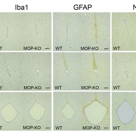 Representative Photomicrographs Of Iba Ir Cells Gfap Ir Areas And