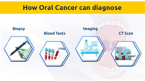 Oral Cancer Treatment Oral Cancer Surgeon Oral Cancer Specialist