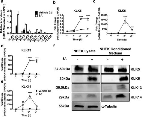 Staphylococcus Aureus Induces Increased Serine Protease Activity In