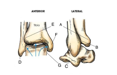 Ankle Joint anterior and lateral Flashcards | Quizlet