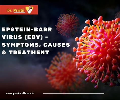 Epstein Barr Virus Ebv Symptoms Causes And Treatment