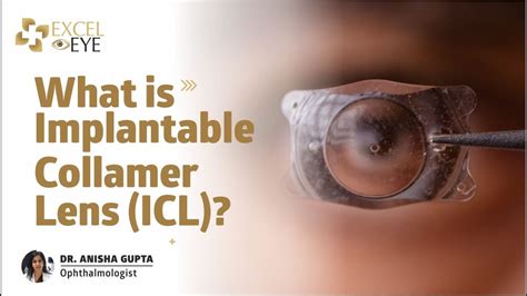 What Is Implantable Collamer Lens Icl Lasik Smile Silk Surgery Dr