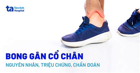 Bong Gân Cổ Chân Nguyên Nhân Triệu Chứng Và Cách Chẩn đoán