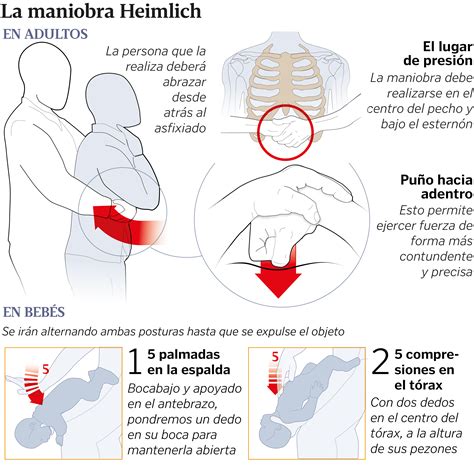 La maniobra de Heimlich guía de instrucciones