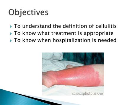 Ppt Cellulitis Powerpoint Presentation Free Download Id3209988