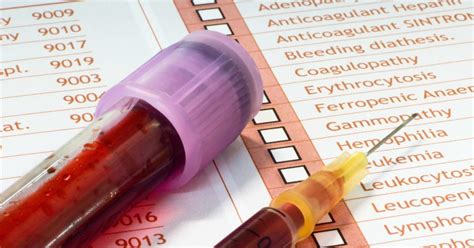 Hepatitis C Antibody Test Results And What To Expect