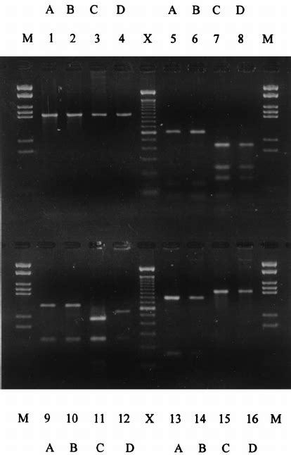 Agarose Gel Electrophoresis Demonstrating The Restriction Patterns Of A