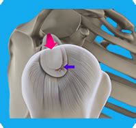 Shoulder Dislocation Birmingham Shoulder Joint Instability Worcester