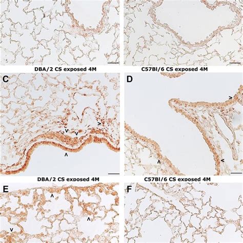 Representative Sections From Lung Parenchyma After Immunolocalization