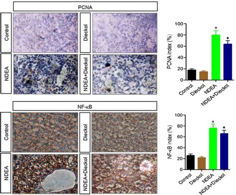 Representative Immunohistochemical Staining Of Pcna And Nf B In The