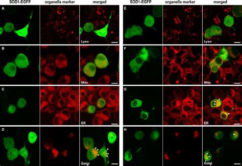 Subcellular Localization Of Egfp Fused Sod In A Neuronal Cell Line