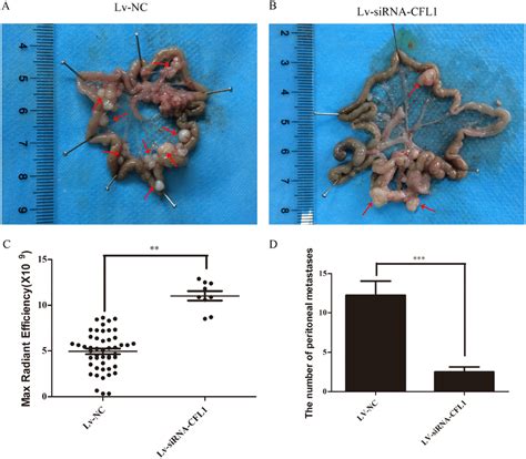 A Metastatic Tumor Cells In The Peritoneal Cavities Of Lv Nc Nude