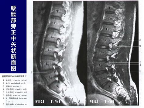 脊柱腰段解剖word文档在线阅读与下载无忧文档