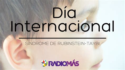 Conoce más acerca del Síndrome de Rubinstein Taybi RADIOMÁS