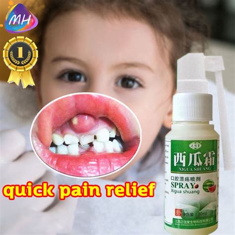 Watermelon Frost Oral Ulcer Spray 30ml To Relieve Bad Breath Tooth