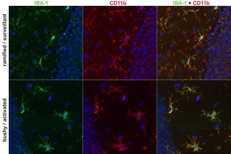 CD11b - a marker of activated microglia