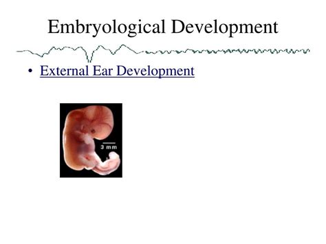 Ppt Anatomy Of The Ear Powerpoint Presentation Free Download Id