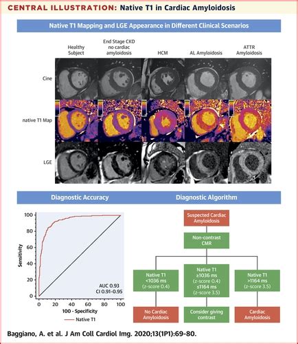 Noncontrast Magnetic Resonance For The Diagnosis Of Cardiac Amyloidosis