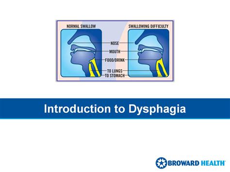 Introduction to Dysphagia