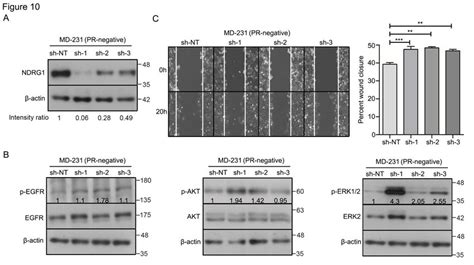 Depletion Of Ndrg1 Activates Multiple Cellular Kinases And Increases