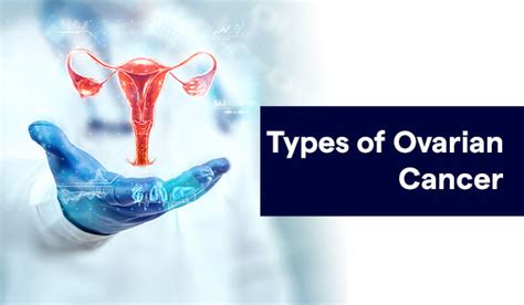 Types of Ovarian Cancer