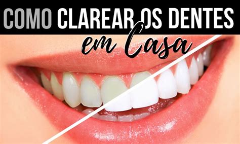 Receitas Para Clarear Os Dentes Em Casa