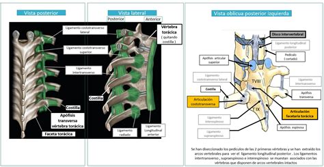 Anatomía De La Columna Dorsal O Torácica Dolopedia