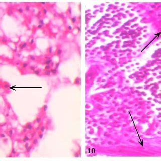 Photomicrograph Of Lung Section From Control Rat Showing Normal