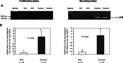 Relative Real Time Qpcr Analyses Were Performed To Determine And